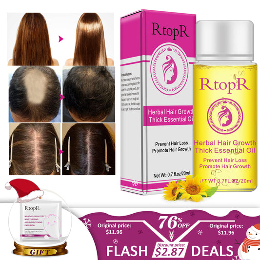 Hair Growth Essential Oil 20ml – Nourishing Scalp Serum for Stronger-Looking Hair & Daily Hair Care